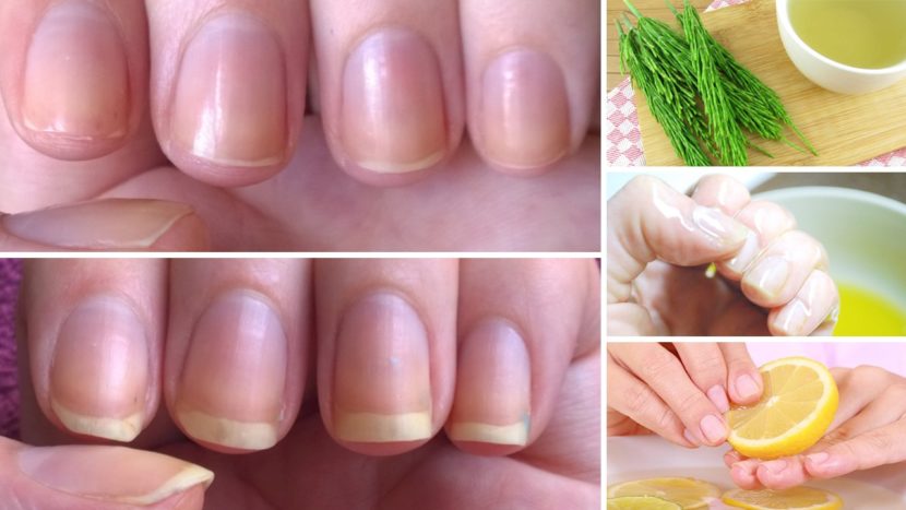 Tips to Grow Your Nails Faster and Stronger